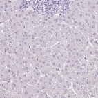 Immunohistochemical staining of human liver shows no cytoplasmic positivity in hepatocytes as expected.