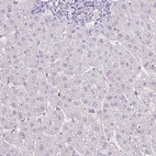 Immunohistochemical staining of human liver shows no cytoplasmic positivity in hepatocytes as expected.