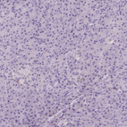 Immunohistochemical staining of human pancreas shows no cytoplasmic positivity in exocrine glandular cells as expected.
