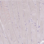 Immunohistochemical staining of human skeletal muscle shows no cytoplasmic positivity in myocytes as expected.