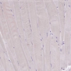 Immunohistochemical staining of human skeletal muscle shows no cytoplasmic positivity in myocytes as expected.