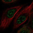 Anti-MAMSTR Antibody