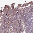 Anti-NHSL2 Antibody