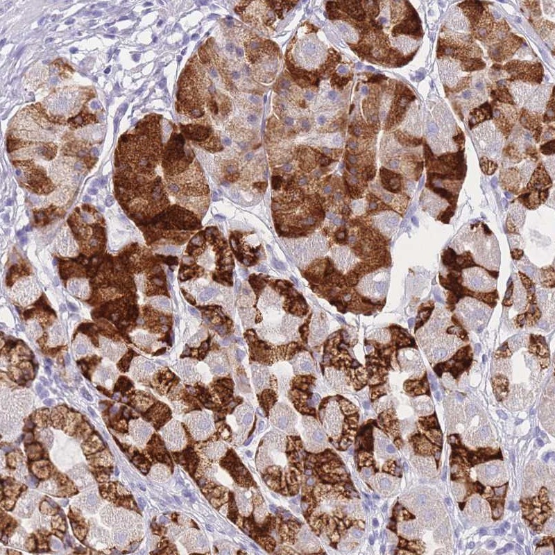 Anti-ZNF627 Antibody