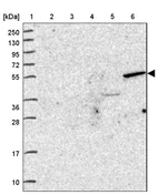 Lane 1: Marker [kDa] 250, 130, 95, 72, 55, 36, 28, 17, 10_br/_Lane 2: Human cell line RT-4_br/_Lane 3: Human cell line U-251MG sp_br/_Lane 4: Human plasma (IgG/HSA depleted)_br/_Lane 5: Human liver tissue_br/_Lane 6: Human tonsil tissue