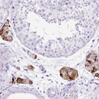 Anti-STOX2 Antibody