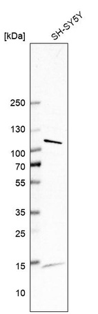 Western blot analysis in human cell line SH-SY5Y.