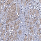 Anti-PAPSS1 Antibody