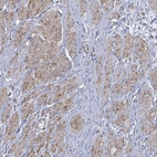 Anti-PAPSS1 Antibody