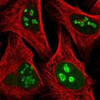 Immunofluorescent staining of human cell line U-2 OS shows localization to nucleus & nucleoli.