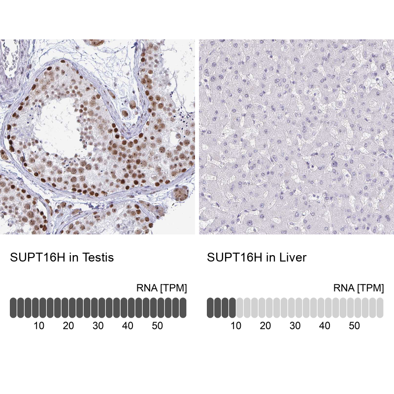 Anti-SUPT16H Antibody