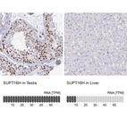 Anti-SUPT16H Antibody