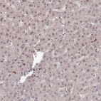 Anti-COL8A2 Antibody