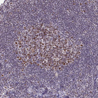 Immunohistochemical staining of human tonsil shows strong nuclear and nucleoli positivity in germinal center cells and non-germinal center cells.