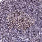 Immunohistochemical staining of human tonsil shows strong nuclear and nucleoli positivity in germinal center cells and non-germinal center cells.