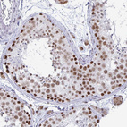 Immunohistochemical staining of human testis shows strong nuclear and nucleoli positivity in cells in seminiferous ducts.