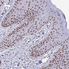 Immunohistochemical staining of human skin shows strong nuclear and nucleoli positivity in squamous epithelial cells.