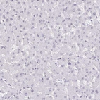 Immunohistochemical staining of human liver shows no positivity in hepatocytes as expected.