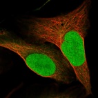 Immunofluorescent staining of human cell line U-2 OS shows localization to nucleus.