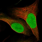 Immunofluorescent staining of human cell line U-2 OS shows localization to nucleus.