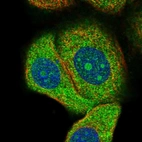 Immunofluorescent staining of human cell line MCF7 shows localization to nucleoli & cytosol.