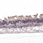 Anti-RGS9BP Antibody