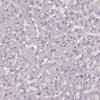 Anti-RGS9BP Antibody
