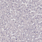Immunohistochemical staining of human liver shows no positivity in hepatocytes as expected.
