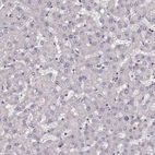 Immunohistochemical staining of human liver shows no positivity in hepatocytes as expected.