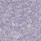 Anti-RGS9BP Antibody