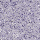 Immunohistochemical staining of human pancreas shows no positivity in exocrine glandular cells as expected.
