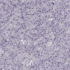 Immunohistochemical staining of human pancreas shows no positivity in exocrine glandular cells as expected.