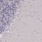 Immunohistochemical staining of human cerebellum shows no positivity in Purkinje cells as expected.