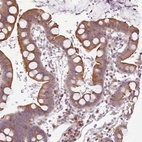 Anti-NMRK1 Antibody