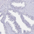 Immunohistochemical staining of human prostate shows no positivity in glandular cells.