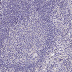 Anti-APOB Antibody