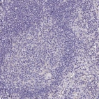 Immunohistochemical staining of human lymphoid tissues shows no positivity in lymphoid cells.