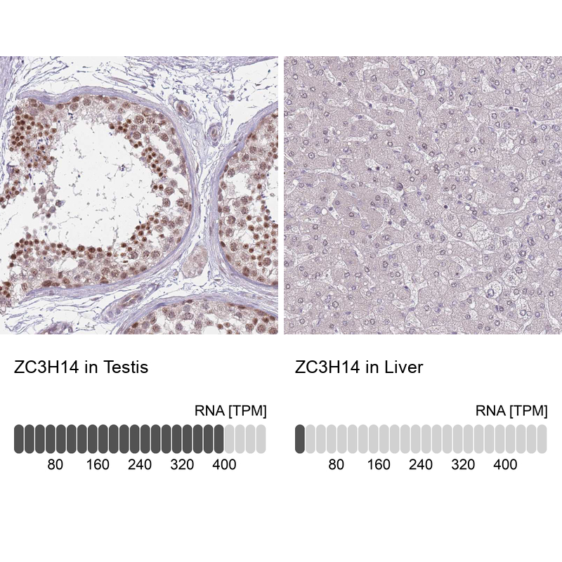 Anti-ZC3H14 Antibody