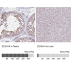 Anti-ZC3H14 Antibody