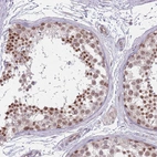 Immunohistochemical staining of human testis shows strong nuclear positivity in cells in seminiferous ducts.