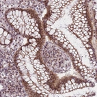 Immunohistochemical staining of human colon shows strong nuclear positivity in glandular cells.