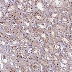 Immunohistochemical staining of human kidney shows moderate nuclear positivity in cells in tubules.