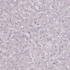 Immunohistochemical staining of human liver shows no nuclear positivity in hepatocytes as expected.