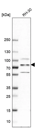 Western blot analysis in human cell line RH-30.