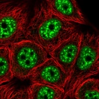 Immunofluorescent staining of human cell line MCF7 shows localization to nuclear speckles.
