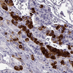 Anti-NPTX2 Antibody