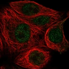 Immunofluorescent staining of human cell line MCF7 shows localization to nucleoplasm.