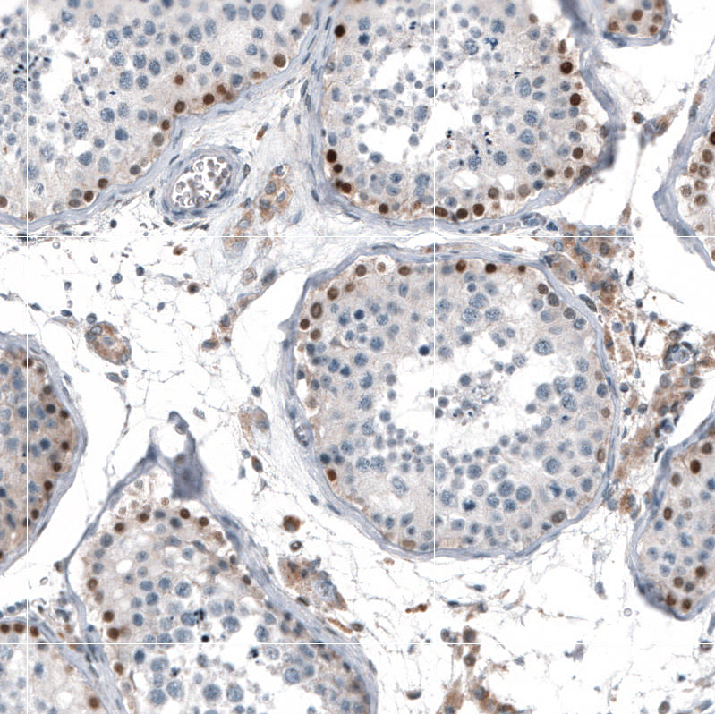 Anti-TCF3 Antibody