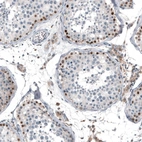 Anti-TCF3 Antibody