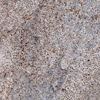 Immunohistochemical staining of human lymphoid tissues shows weak to moderate nuclear positivity in non-germinal center cells.